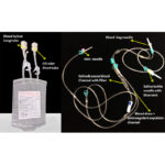 Ozone Major Autohemotherapy Kit Blood Therapy - Image 3