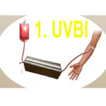UVBI Ultraviolet Blood Irradiation Machine For Blood Treatment - Image 6