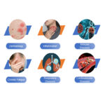 UVBI Ultraviolet Blood Irradiation Machine For Blood Treatment - Image 9